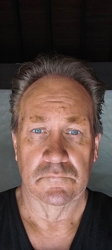Mr D, 54 Sydney, New South Wales, Australia